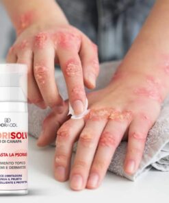 Sorisolv - Psoriasis Cream